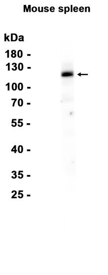 CD41 (YD15089) Rabbit mAb