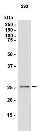 AYD14963