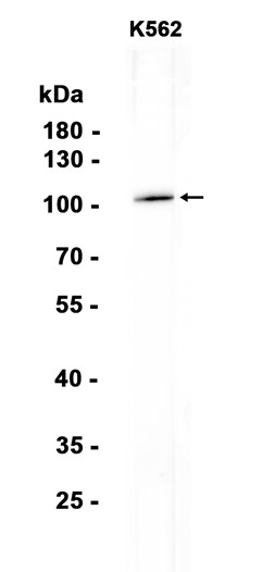 AYD14292