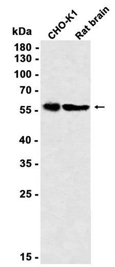 AYD11864