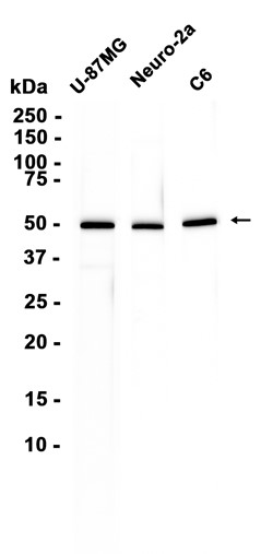 beta II Tubulin (YD35288) Mouse mAb