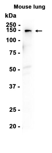 Collagen VI (YD15754) Rabbit mAb