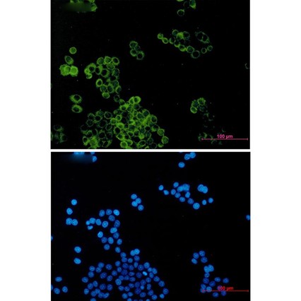 Dynein Light Chain Tctex Type 1 (YD32413) Rabbit mAb