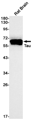 AYD12335