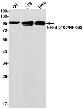 AYD11265