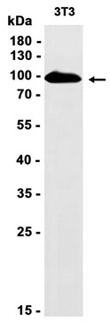 Thrombomodulin (YD15362) Rabbit mAb