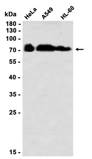 Phospho-PKC zeta/lambda (Thr410/Thr412) (YD32134) Rabbit mAb