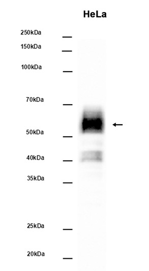 AYD14952