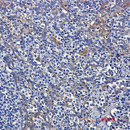 AYD14065-ihc1
