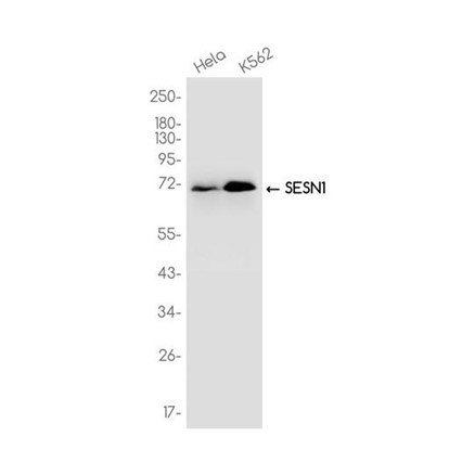 AYD14972
