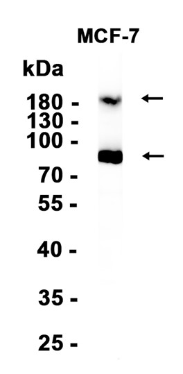 ErbB 4 (YD11994) Rabbit mAb