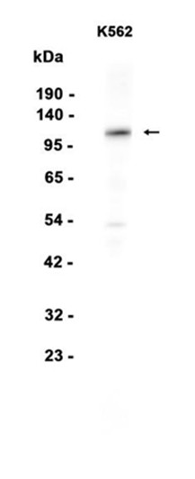 AYD15978