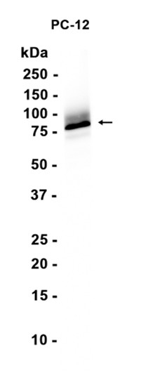 Chromogranin A (YD19800) Rabbit mAb