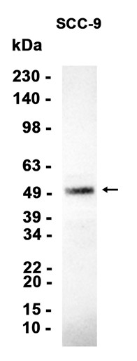 CLN5 (YD15600) Rabbit mAb