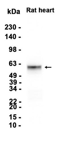 MEF2A (YD15742) Rabbit mAb