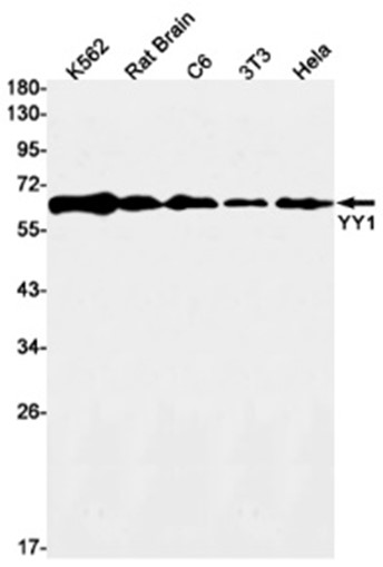 AYD11605