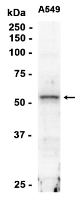 Cyclin B1 (YD14937) Rabbit mAb