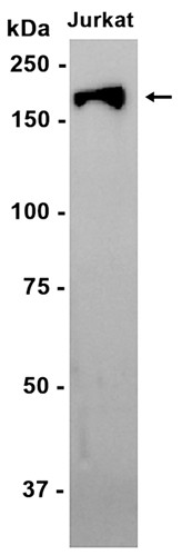 AYD15561
