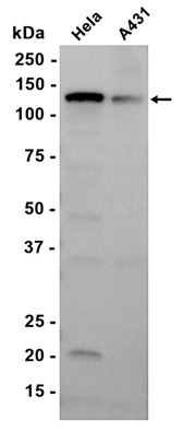 AYD15578