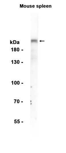 Integrin beta 4 (YD11587) Rabbit mAb