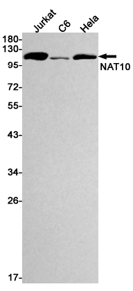 AYD11843