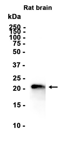 Ferritin Heavy Chain (YD31198) Rabbit mAb