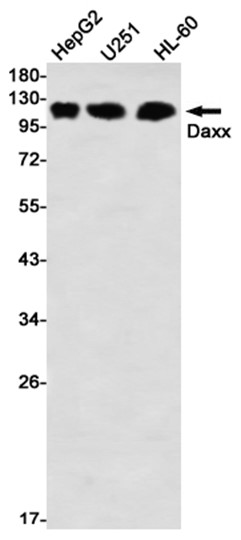 Daxx (YD31549) Rabbit mAb