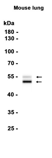 AYD11336