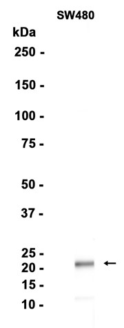 AYD14730