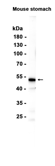 GSDMC (YD20789) Rabbit mAb