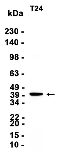 AYD12611