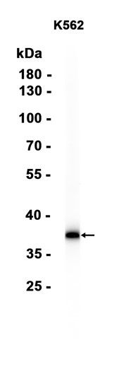 AYD15509