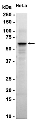 AYD15456