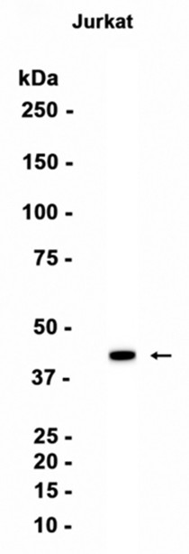 AYD15920