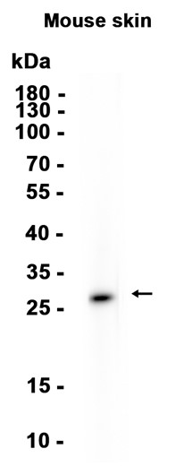 AYD14425
