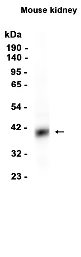 EpCAM (YD15844) Rabbit mAb