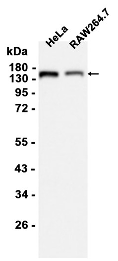 AYD11120
