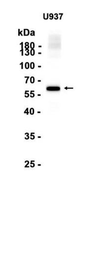 AYD14928