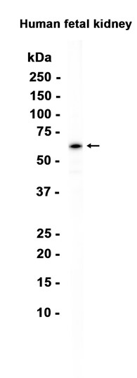 AYD14406