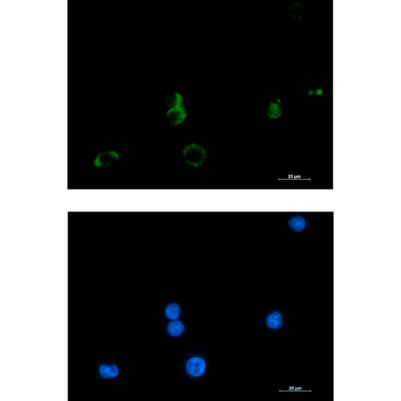 Prostaglandin D Synthase (YD19059) Rabbit mAb