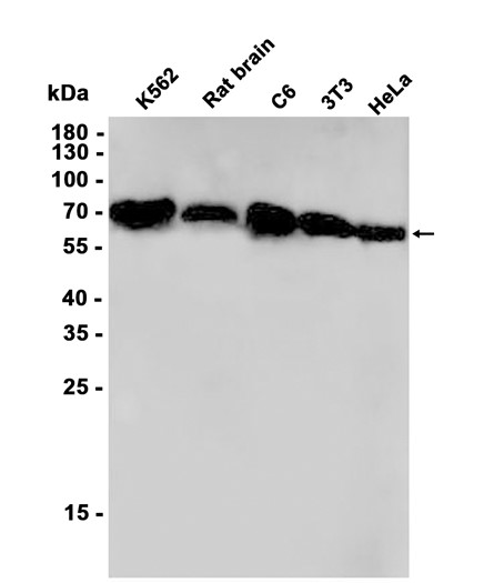 Lamin B1 (YD11146) Rabbit mAb