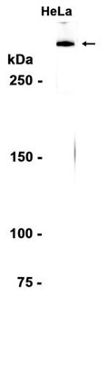AYD15410