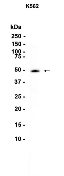 Casein Kinase 1 gamma 2 (YD31743) Rabbit mAb