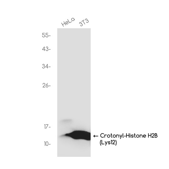 Crotonyl-Histone H2B (Lys12) (YD11780) Rabbit mAb