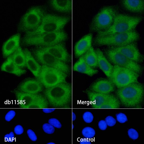 IL-2 Receptor alpha (YD16863) Rabbit mAb