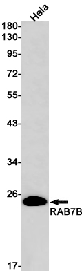 AYD14923