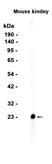 AYD15203