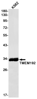 AYD11274