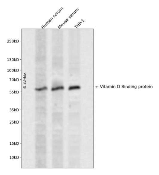 Vitamin D Receptor (YD19903) Rabbit mAb