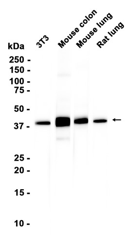 alpha smooth muscle Actin (YD32859) Mouse mAb